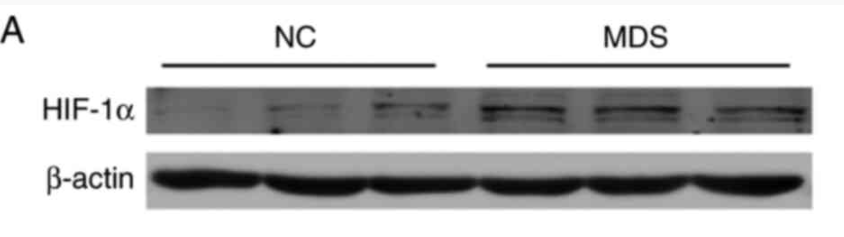 HIF1A Antibody - Figure 2.