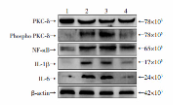 Cleaved-IL-1 beta (Asp116) Antibody - 1：假手术组；2：ICH组；3：ICH+DMSO+PEG400组；4：ICH+NGN中剂量组A：Western blot检测大鼠ICH后PKC-δ、Phospho PKC-δ、NF-κB、IL-1β、IL-6的表达；B：PKC-δ的相对磷酸化水平；C~E：分别为NF-κB、IL-1β、IL-6的相对表达水平a：P < 0.