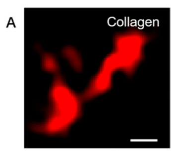 Collagen I Antibody - Figure 4.
