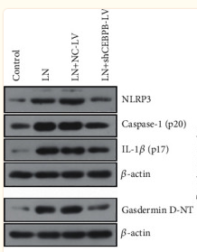 Cleaved-Caspase 1 (Asp296), p20 Antibody - Figure 4 The knockdown of CEBPB inhibited the activation of NLRP3 inflammasomes in MRL/lpr mice.