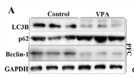 LC3A/B Antibody - Figure 3.