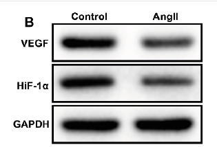 VEGFA Antibody - FIGURE 5 EUE upregulates Hif-1α and VEGF expression by inactivating p53 to alleviate AngII-induced CMVEC dysfunction.