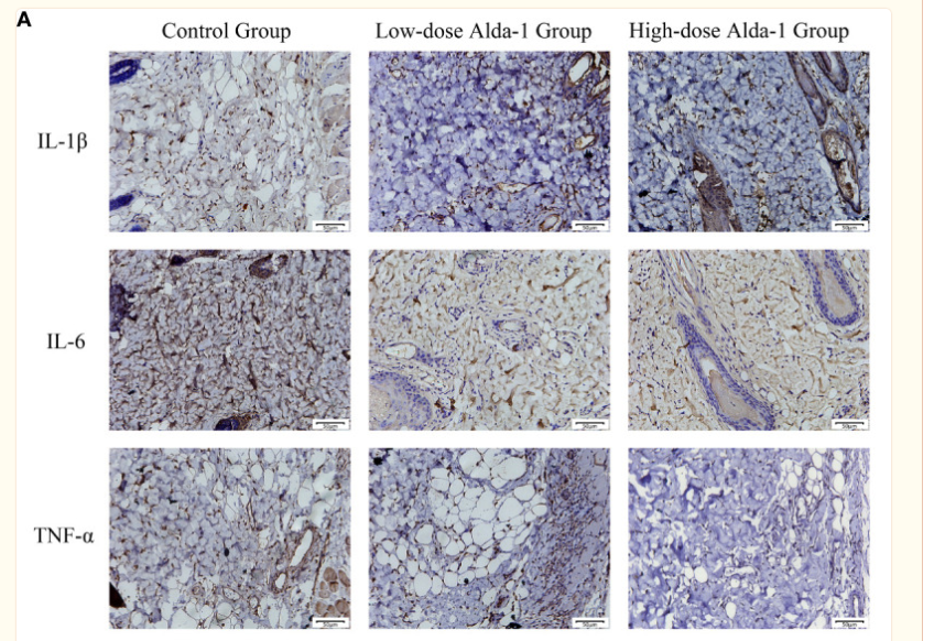 IL6 Antibody - Figure 7 (A) Immunohistochemistry images of IL-1β, IL-6 and TNF-α.