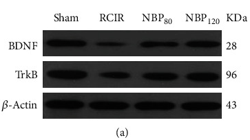 BDNF Antibody - Figure 2 NBP promoted BDNF/TrkB signaling and reduced cell death caused by RCIR injury.