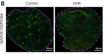 PCNA Antibody - Figure 4: The bioactive artificial nerve promotes Schwann cell proliferation in the injured area after sciatic nerve injury.
