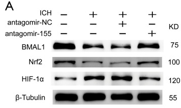 HIF1A Antibody - Figure 7 Effects of increased BMAL1 on the Nrf2 signaling pathway after ICH.