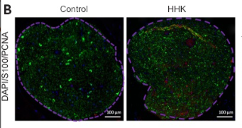 PCNA Antibody - Figure 4: The bioactive artificial nerve promotes Schwann cell proliferation in the injured area after sciatic nerve injury.