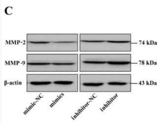 MMP2 Antibody - Figure 2.