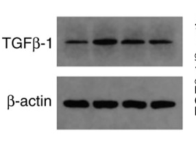 TGF beta 1 Antibody - Figure 4 Western blotting analysis of expression of TGFβ-1 protein.