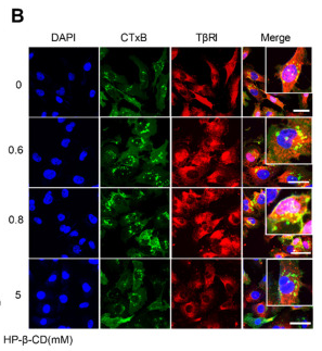 TGFBR1 Antibody - Figure 6 The effect of different concentrations of HP-β-CD on the expression and distribution of TβRI.