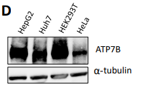 Tubulin alpha Antibody - Figure 2: Distribution of ATP7B and ATP7A in hepatic and non-hepatic cell lines (A) Immunofluorescence image of ATP7B (green) in Huh7 cell line co-stained with LAMP2 (red) and TGN46 (blue) shows presence of ATP7B on both the compartments, irrespective of cellular copper conditions.