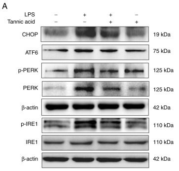 Phospho-IRE1 (Ser724) Antibody - Figure 4.