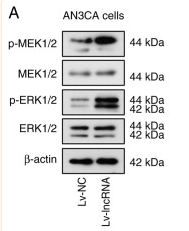 ERK1/2 Antibody - Figure 4.