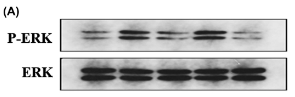 ERK1/2 Antibody - FIGURE 6 Pre-ischemic renal lavage (PIL) inhibited phosphorylation of ERK and the p65 subunit of NF-κB in the kidneys of rats with renal ischemia-reperfusion.