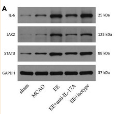 IL6 Antibody - FIGURE 5 Enriched environment (EE) treatment increased the protein and mRNA levels of the angiogenesis-associated factors IL-6, JAK2, and STAT3 in the penumbra in an interleukin-17A (IL-17A)-dependent manner 21 days after middle cerebral artery occlusion (MCAO).