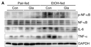 IL6 Antibody - Figure 2 Gla ameliorated liver inflammation induced by ethanol via activating the NF-κB pathway in vivo.