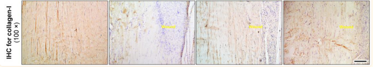 Collagen I Antibody - Fig.