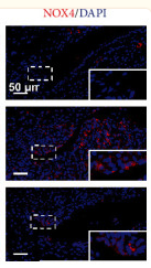 NOX4 Antibody - Figure 6 Histological analysis of the therapeutic effect of GLX on CFA-induced TMJ inflammation in rats.