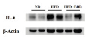 IL6 Antibody - Figure 2 BBR suppresses inflammatory cytokines and repairs gut barrier function in CRC model mice fed with HFD.
