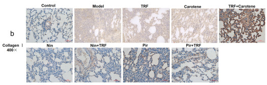 Collagen I Antibody - Figure 7 Amelioration of bleomycin-induced PF: Lungs from different rat groups were collected, and 5-μm thick sections were prepared and used for the assessment of tissue injury; representative images of IHC staining for collagen I in the lungs: (a) original magnification: 100×; (b) original magnification: 400×; n = 8.