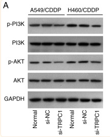 PI3K p85 alpha Antibody - Figure 5.