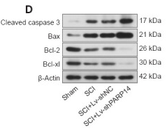 Bcl-2 Antibody - Figure 3 PARP14 deficiency exacerbates SCI-induced neuronal apoptosis at 7 days post-SCI.