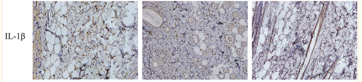 IL1 beta Antibody - FIGURE 7 (A) Magnification after immunohistochemical staining with different pro‐inflammatory cytokines on day 7.