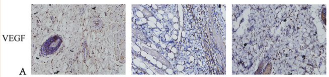 TNF alpha Antibody - FIGURE 8 (A) Magnification after immunohistochemical staining of hypoxia‐inducible factor‐1α (HIF‐1α) and vascular endothelial growth factor (VEGF) on day 7.