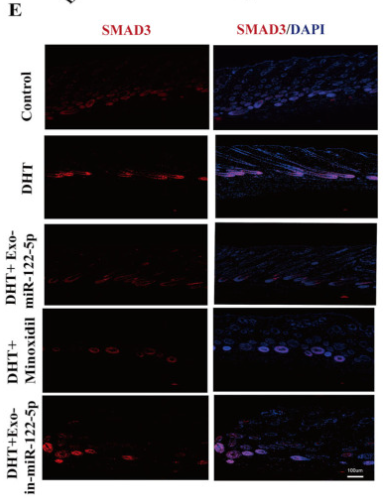 Bcl-2 Antibody - Figure 6 Exo-miR-122-5p mitigates the inhibitory effect of DHT on HFs in C57BL/6 mice.
