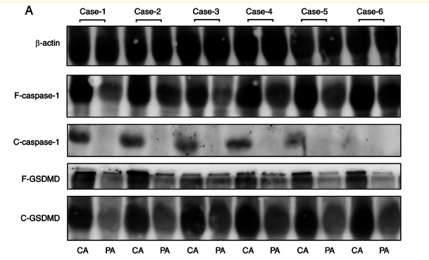 GSDMD Antibody - Figure 1.