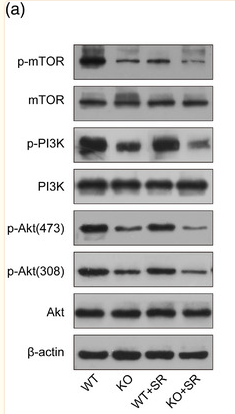 Phospho-AKT1/2/3 (Ser473) Antibody - FIGURE 4 The expression of PI3K/Akt‐mTOR signal pathway in four groups mice: (a) the schematic diagram of expression levels in p‐mTOR, mTOR, p‐PIK3, PI3K, p‐Akt(473), p‐Aky(308), and Akt, measured by Western blot; (b–e) the semiquantitative analysis of the expression of p‐mTOR (b), p‐PI3K (c), p‐Akt(473) (d), and p‐Akt(308) (e).