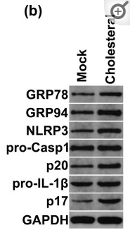 IL1 beta Antibody - Figure 2 Effects of cholesterol on the inflammatory response and the expression of endoplasmic reticulum-related molecules in beta-TC-6 cells.
