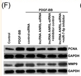 MMP9 Antibody - Figure 3 Silencing of long noncoding RNAs (LncRNA) ANRIL inhibited proliferation and migration in platelet‐derived growth factor‐BB (PDGF‐BB)‐induced ASMCs through upregulating miR‐7‐5p.