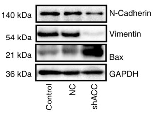 N Cadherin Antibody - Figure 7 Effect of ACC gene interference on related protein expression detected by western blotting in tumor tissues.