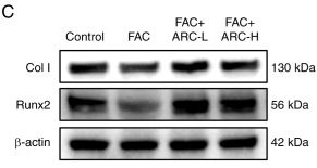 Collagen I Antibody - Figure 4 ARC attenuates the inhibitory effect of iron overload on MC3T3-E1 cell osteogenesis.
