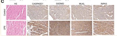 GSDMD Antibody - Figure 7 Necroptosis is activated in the heart tissues of the sepsis-induced myocardial dysfunction model mice.