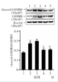 GSDMD Antibody - 图 6 柴胡皂苷D对免疫性肝纤维化大鼠肝脏组织中NLRP3炎症小体和细胞焦亡蛋白的影响(n=8，x±s).