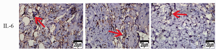 IL6 Antibody - Figure 10.
