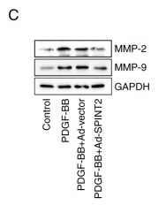MMP9 Antibody - Figure 5 Overexpression of SPINT2 inhibits SMC migration and expression of MMPs.