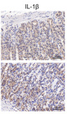IL1 beta Antibody - Figure 5 The IL-6/STAT3 signaling pathways were activated in CAG gastric tissue.