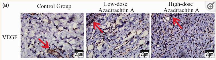 VEGFA Antibody - Figure 10.