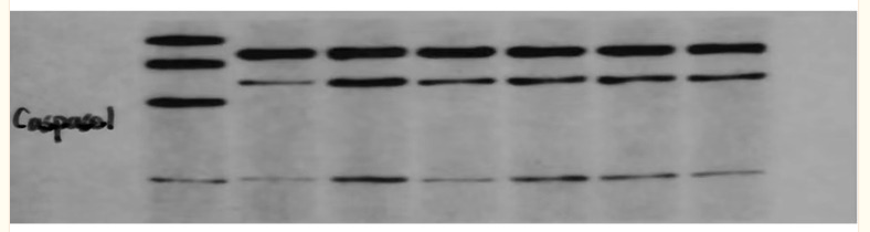 Caspase 1 Antibody - Figure 1 Expression of NLRP3, Caspase-1, and GSDMD in the decidua of pregnant rats in each group.
