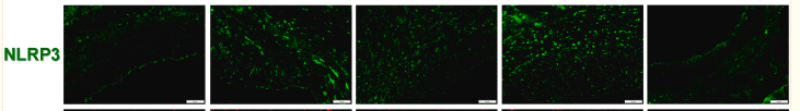 NLRP3 Antibody - Fig.