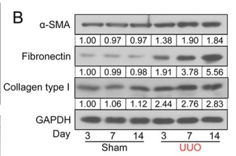 Collagen I Antibody - Figure 2 The expression level of FOSL2 is elevated in UUO-injured kidneys.