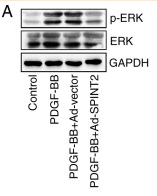 ERK1/2 Antibody - Figure 7 SPINT2 regulates SMC phenotypic transition via activation of the ERK signaling pathway.