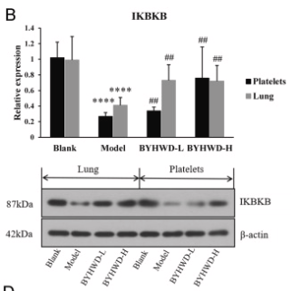 IKBKB Antibody - Fig.
