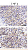 TNF alpha Antibody - Figure 5 The IL-6/STAT3 signaling pathways were activated in CAG gastric tissue.
