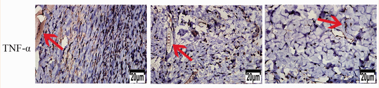 TNF alpha Antibody - Figure 10.