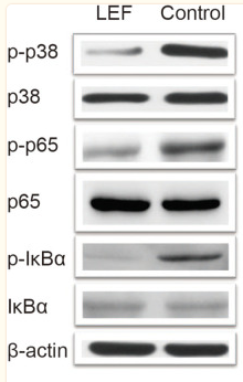 NF-kB p65 Antibody - Figure 4.
