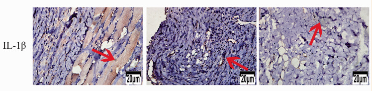 IL1 beta Antibody - Figure 10.